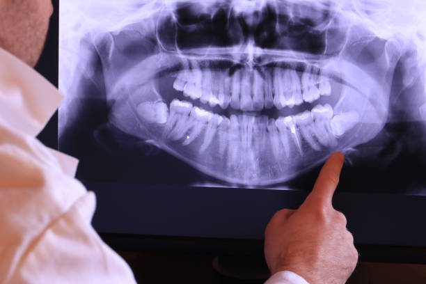 Best Teeth Whitening  in Rose Hill, NC