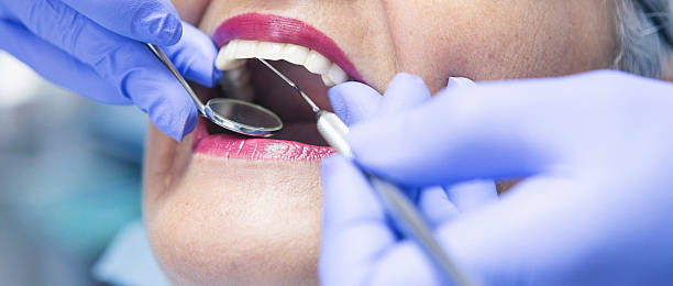 Best Chipped Tooth Repair Near Me  in Rose Hill, NC