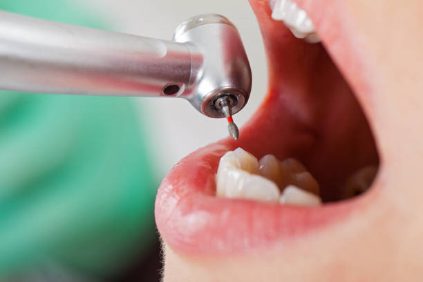 Best Urgent Tooth Repair  in Rose Hill, NC